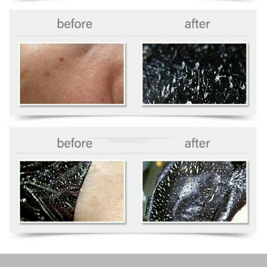 Маска для лица с вулканическим пеплом